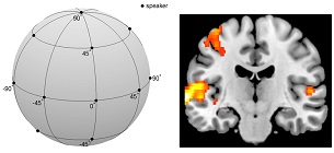 fMRI